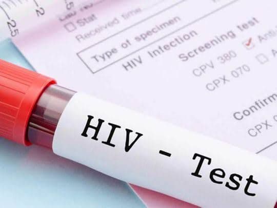 2208_kasus_hiv_di_sumut_hingga_agustus_2023