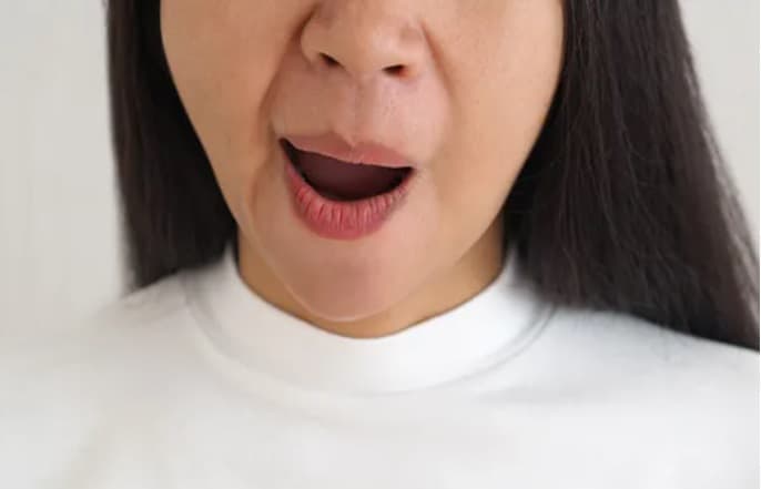 awas_bells_palsy_menyerang_kenali_dan_atasi