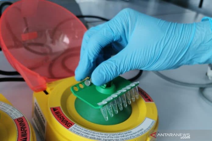 indonesia_miliki_purwarupa_alat_test_corona