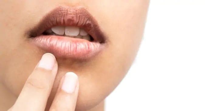 kebiasaan_yang_membuat_bibir_anda_gelap