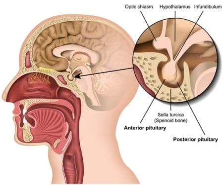 kenali_secara_dini_penyakit_tumor_hipofisis