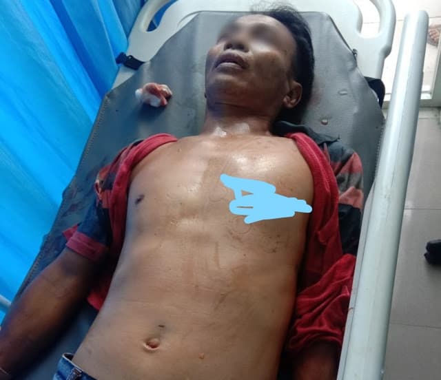 sopir_tewas_ditusuk_obeng_di_hamparan_perak