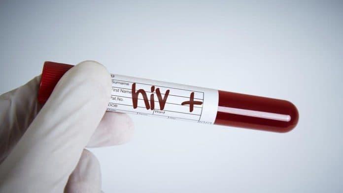 uji_coba_vaksin_hiv_skala_besar_gagal