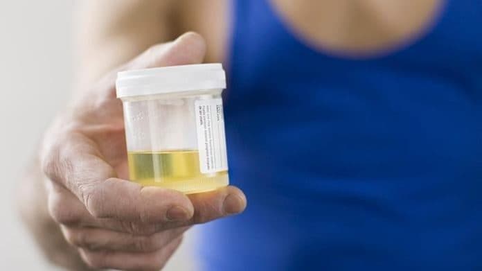 urine_berwarna_hati_hati_5_penyakit_ini