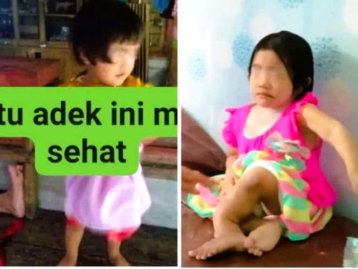 kisah_pilu_anak_alami_patah_kaki_di_nisel_berawal_saat_orang_tuanya_cerai
