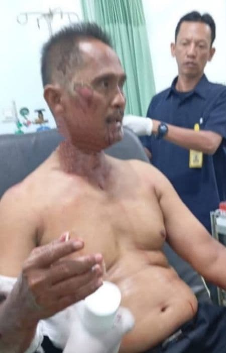 leher_tukang_ojek_di_sergai_luka_usai_melawan_perampok