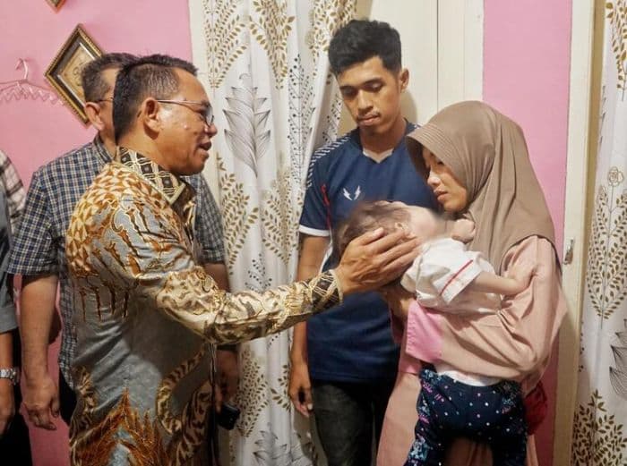 dokter_spesialis_rsup_adam_malik_tangani_bocah_pengidap_kanker_mata_stadium_4