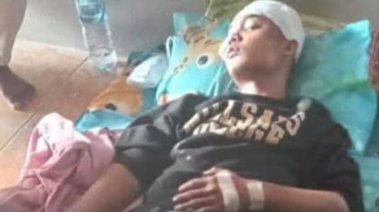 begal_beraksi_di_deli_serdang_dua_pemuda_dibacok_dan_satu_selamat_masuk_parit