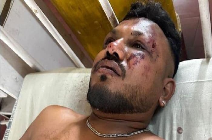 kisah_vishwash_ramesh_satusatunya_korban_selamat_tragedi_air_india_di_ahmedabad