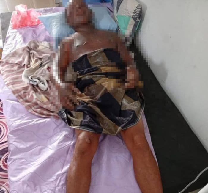 tersangka_pelaku_pembakaran_ayah_kandung_ditembak_di_belawan