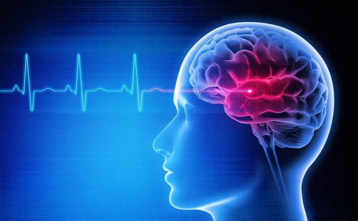 berjalan_kaki_turunkan_risiko_stroke_berapa_lama_harus_dilakukan