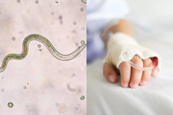 balita_di_seluma_keluarkan_cacing_dari_mulut_dan_hidung_kini_dirawat_intensif