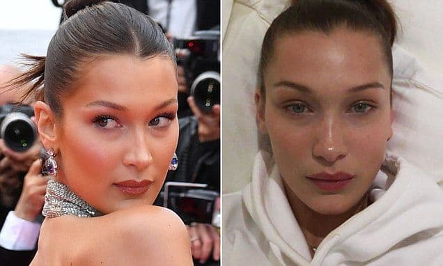 bella_hadid_ungkap_perjuangan_panjang_melawan_penyakit_lyme