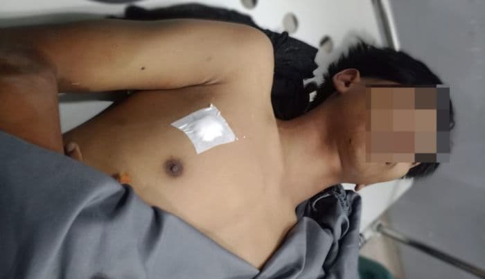 remaja_di_belawan_tewas_tertembak_senapan_angin_saat_bentrok_antar_warga_