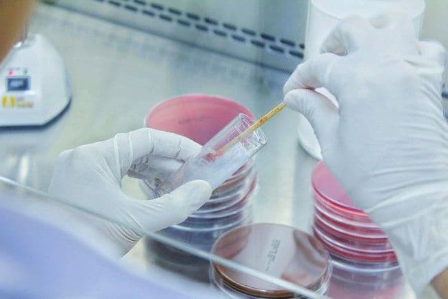 pb_idi_pemeriksaan_sputum_jadi_standar_diagnosis_tuberkulosis