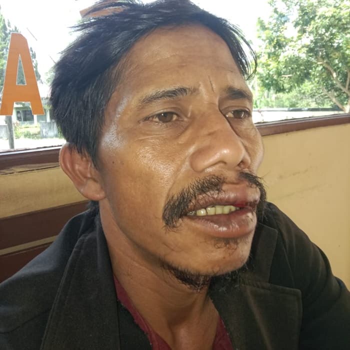 pebisnis_jengkol_jadi_korban_pengeroyokan_di_dairi_melapor_ke_polisi