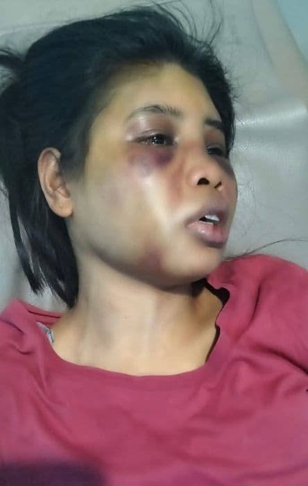 art_disiksa_brutal_pakai_obeng_di_batam_keluarga_desak_pelaku_ditangkap