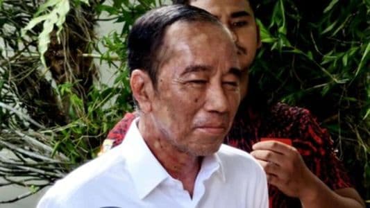 kondisi_wajah_bikin_khawatir_ajudan_pastikan_jokowi_hanya_alami_alergi_kulit