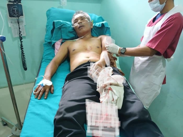 jaksa_kejari_deli_serdang_dan_temannya_dibacok_otk_usai_kontak_pengurus_ormas