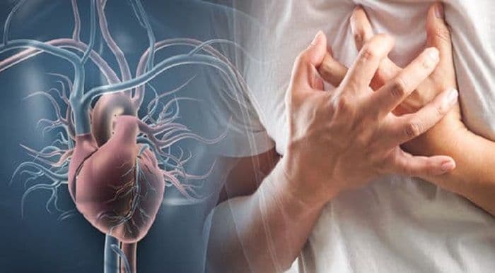 tips_kesehatan_jemaah_haji_dengan_penyakit_jantung_dokter_ingatkan_risiko