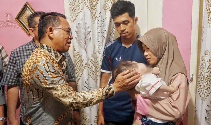 wawako_medan_gerak_cepat_rujuk_bocah_pengidap_kanker_mata_ke_rsup_h_adam_malik