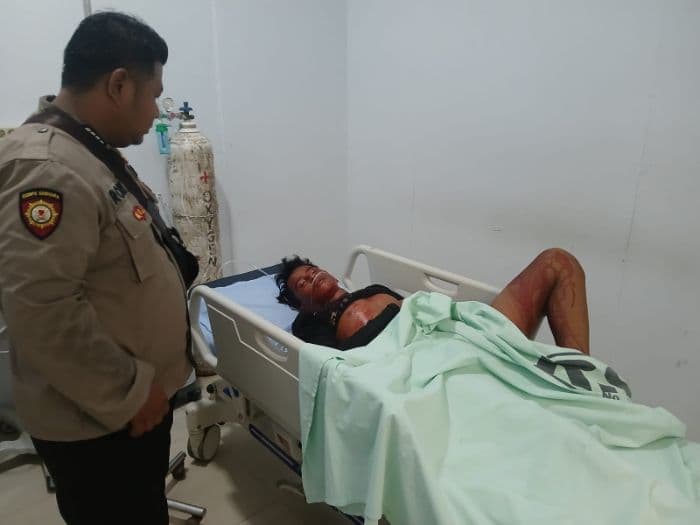 remaja_16_tahun_di_babalan_langkat_jadi_korban_gigitan_monyet_liar_luka_serius_di_leher