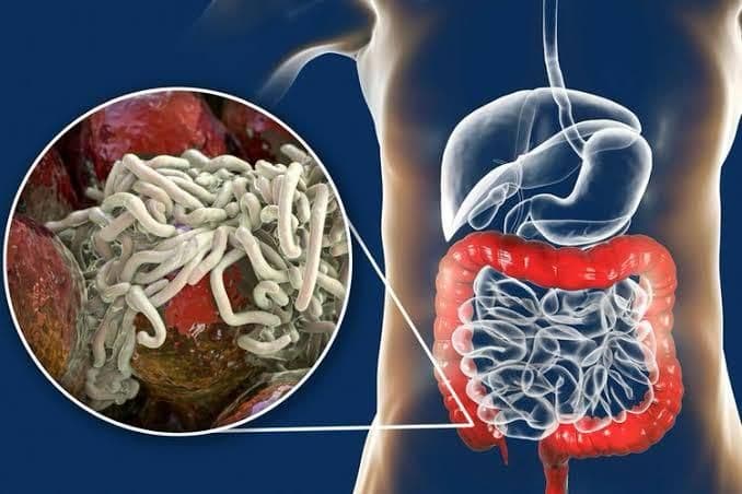 idai_cegah_penyakit_cacingan_dengan_menjaga_kebersihan_dan_konsumsi_obat