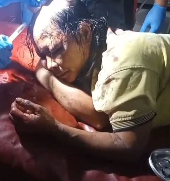 menolak_keluar_dari_tanah_garapan_di_deli_serdang_irt_dikeroyok_hingga_babak_belur