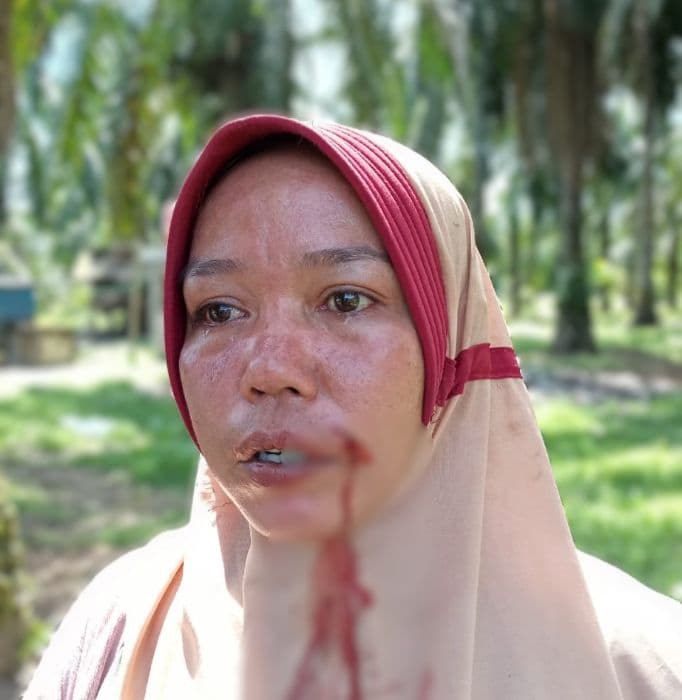 oknum_anggota_tni_diduga_aniaya_dua_wanita_di_langkat