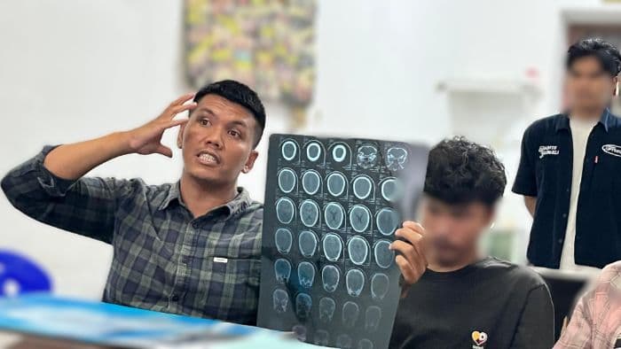 kronologi_mahasiswa_medan_dianiaya_polisi_saat_demo_padahal_tak_ikut_aksi_pendarahan_di_kepala