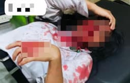 siswi_diduga_disayat_temannya_di_sekolah_taman_siswa_binjai_pelakunya_sudah_ditangkap
