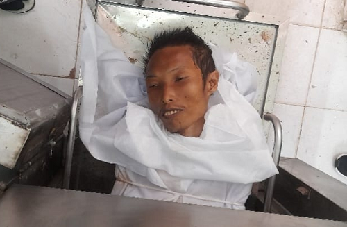 3_hari_di_rsud_siantar_jenazah_mr_x_belum_dijemput_keluarga