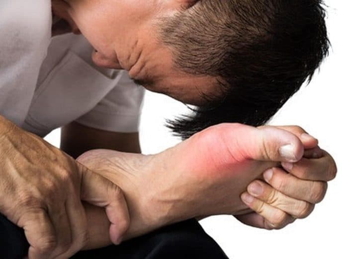 6_makanan_dan_minuman_yang_harus_dihindari_penderita_asam_urat