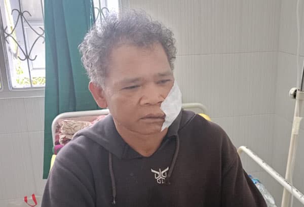 abang_bacok_rahang_adik_di_tigalingga_dairi_motifnya_gara_gara_warisan