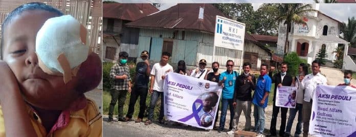 aksi_sosial_bantu_si_bocah_alfaro_gultom_penderita_tumor_ganas