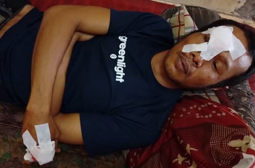 amridjal_warga_belawan_dibacok_gerombolan_bersepeda_motor