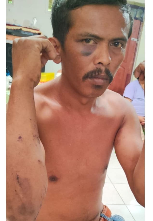 aniaya_pekerja_tauke_botot_dilaporkan_ke_polres_dairi