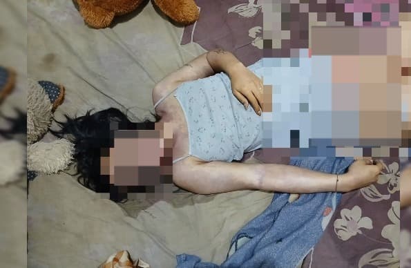 asam_lambung_akut_penyebab_tewasnya_biduan_transgender_di_kisaran