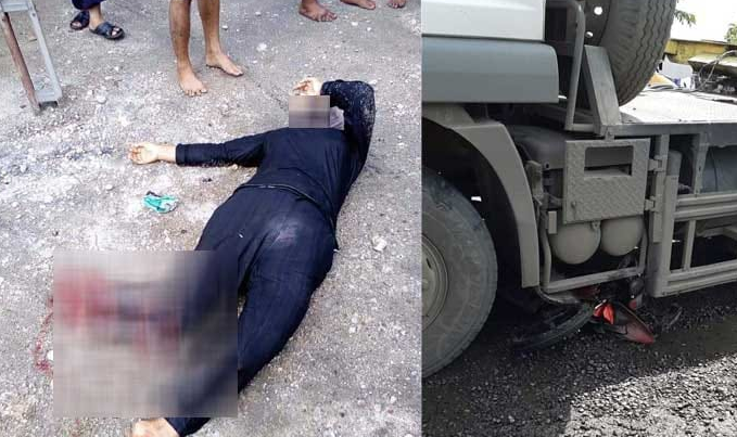 asn_nyaris_tewas_kaki_kanannya_remuk_terlindas_truk