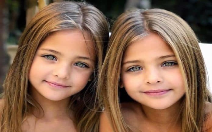 bagaimana_sidik_jari_anak_kembar_identik_bisa_berbeda