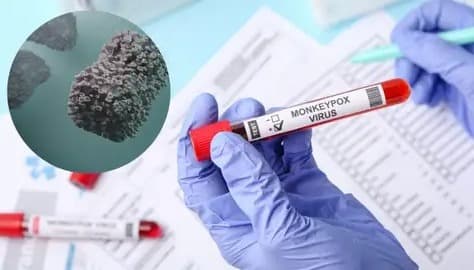 bandara_bali_pasang_3_thermal_scanner_untuk_deteksi_awal_virus_mpox