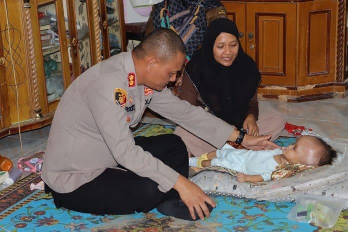 bayi_7_bulan_penderita_hidrosefalus_di_asahan_dapat_perhatian