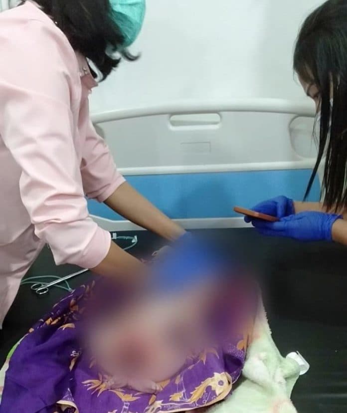 bayi_yang_ditemukan_di_kebun_teh_sidamanik_meninggal