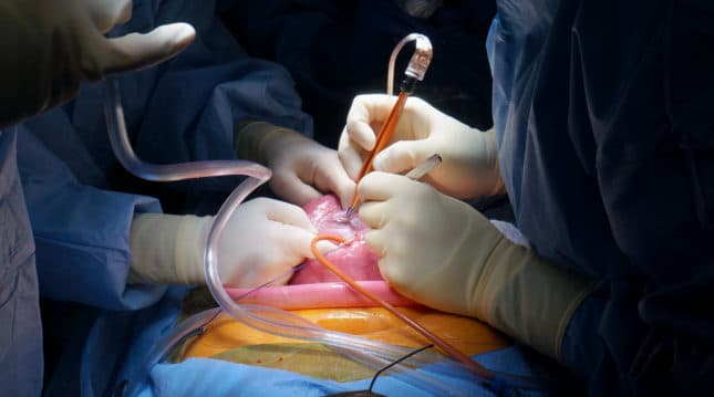 beberapa_kondisi_medis_yang_bisa_ditangani_lewat_fetal_surgery