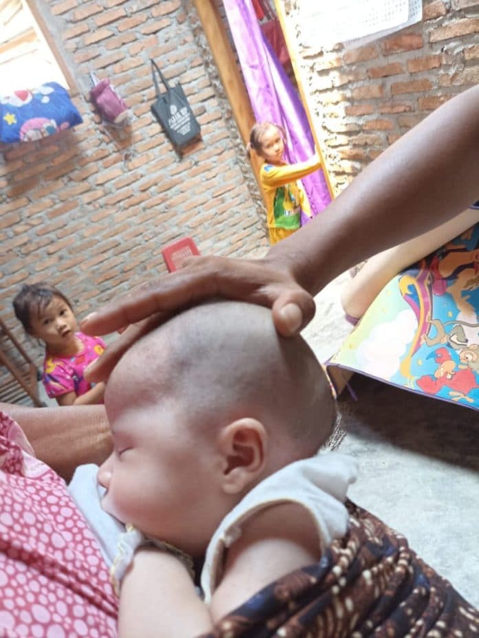 benjolan_di_kepala_makin_besar_bayi_41_hari_di_sergai_butuh_uluran_tangan