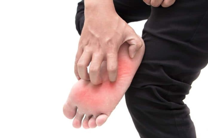berbagai_hal_yang_bisa_menyebabkan_kaki_terasa_panas_di_malam_hari