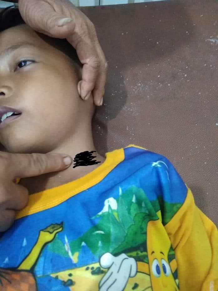 bocah_10_tahun_tewas_kesetrum_dari_kabel_listrik_yang_putus_di_sergei