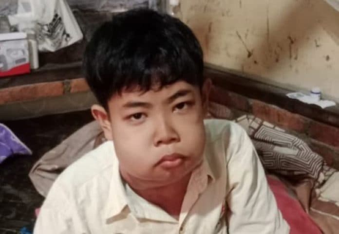 bocah_13_tahun_penderita_tumor_di_rantauprapat_butuh_uluran_tangan