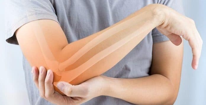 cek_kesehatan_tulang_sejak_dini_bisa_cegah_osteoporosis