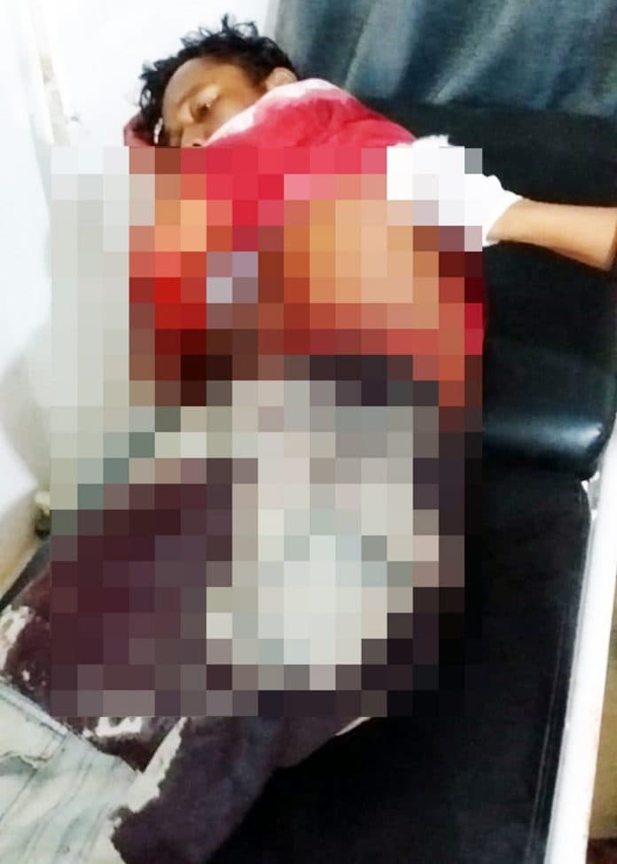 cekcok_dengan_istri_suami_bersimbah_darah_ditikam_adik_ipar_di_dairi